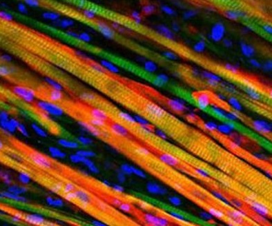 long-colorful-strands-engineered-muscle-fiber-hg