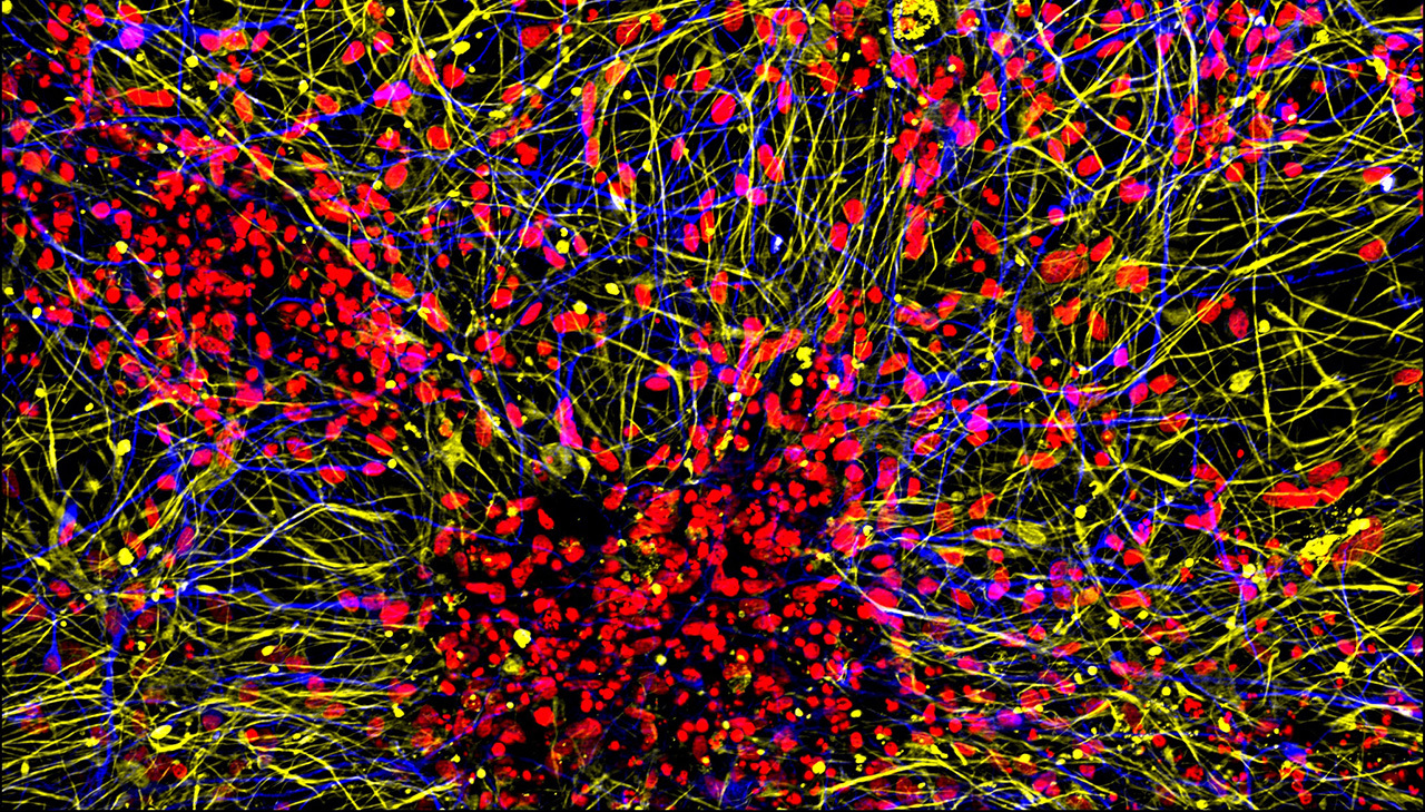 spx29-brain-organoids